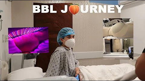 MY BBL JOURNEY IN MEXICO... here is what happened!