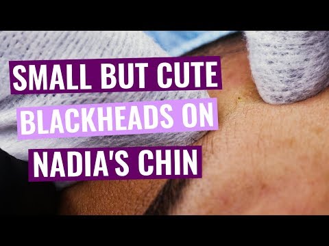 Small, but yet Cute Blackheads Around Nadia's Chin