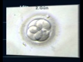 Embriyo Gelişimi - Tüp Bebek