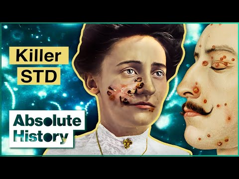 Death By Syphilis: The Real Origins Of The Killer Infection | Syphilis Enigma | Absolute History