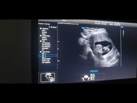 Video how baby looks at 3 months, - youtube