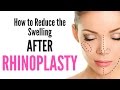 How to Reduce the SWELLING after Undergoing RHINOPLASTY?