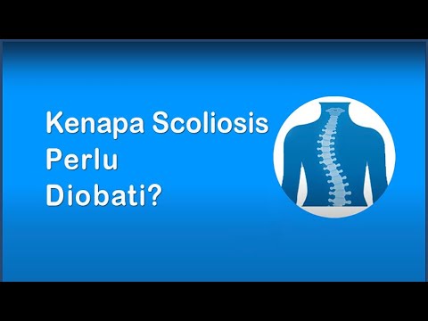 Youtube Skoliosis Idiopatik