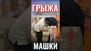 Упражнения для грыжи позвоночника/ Грыжа машки