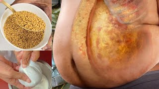 கரையா தொப்பையை கரைத்திட வெந்தய பால் குடிங்க Weight Loss Breakfast in Tamil/Vendhayam/Fenugreek Seeds