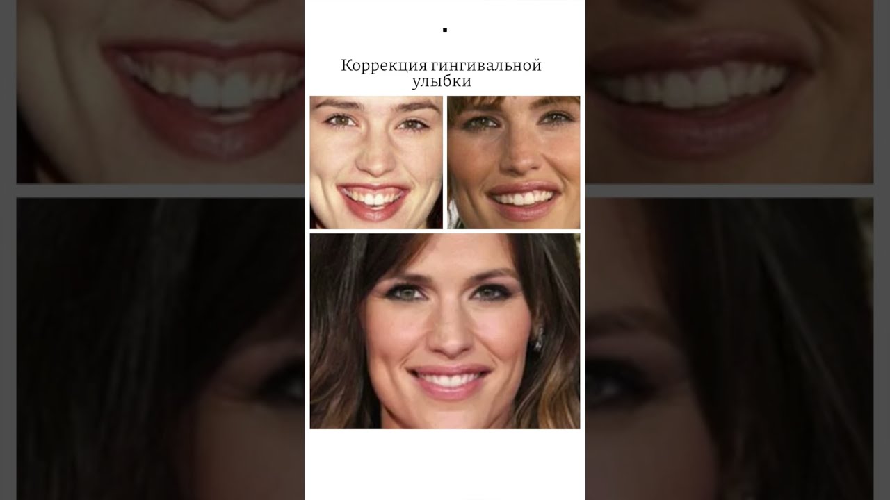 Исправить Улыбку На Фото Онлайн