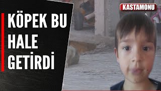 MERT'İN DUDAĞINI KÖPEK ISIRDI Resimi