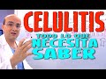 CELULITIS - Todo lo que necesita saber - Enfermedades #17