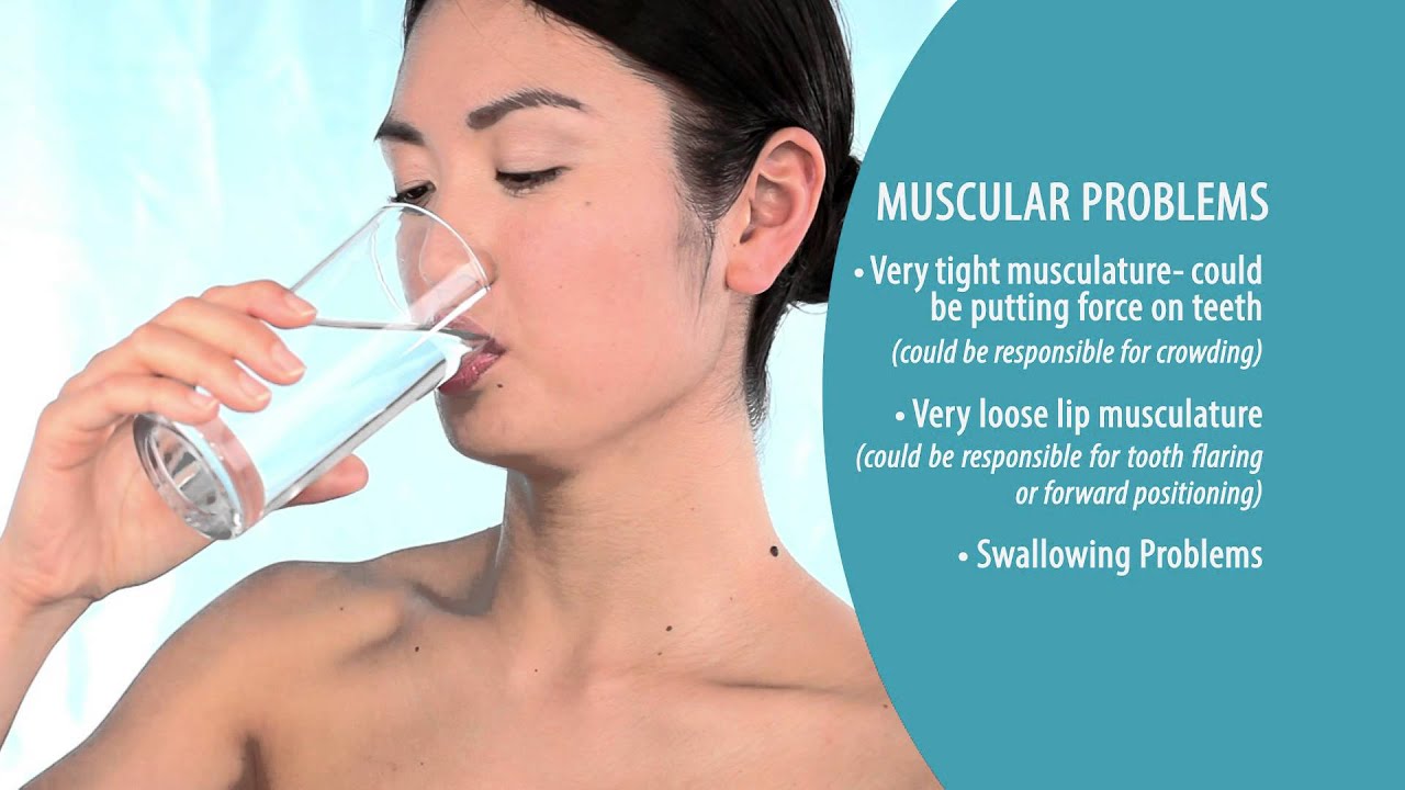 How Do Muscular Problems Affect My Teeth? - YouTube