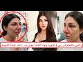 The Doctor Disfigured Her Face And Her Nose Became Massive How Lebanese Artist Joelle Badr Was 