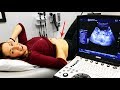 Doctor Knows the Baby's Gender! - 14 Week Pregnancy Ultrasound