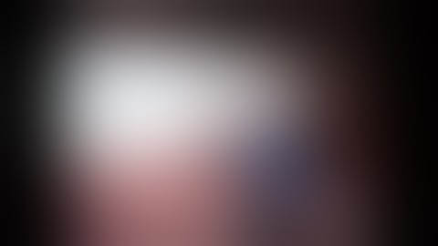 Robotic Left Upper Lobectomy - Easiest2