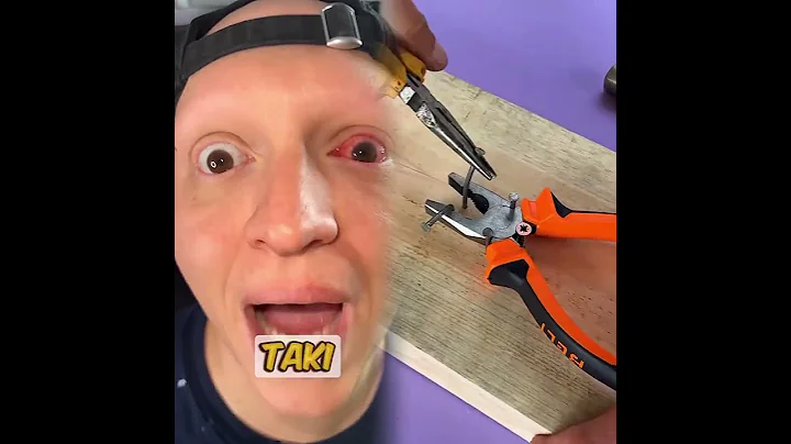 When you have pink eye #comedy #funny #gamer #relatable #skit