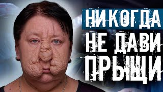 ПЛАСТИЧЕСКИЕ ХИРУРГИ МЕЛЬНИКОВ И ГЛУШКО СПАСЛИ ЛИЦО. ЖИЗНЬ ДО И ПОСЛЕ