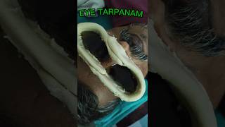 👁️ How is Netra Tarpana Actually Performed?🩺 Step-by-Step Procedure & Clinical Indications Explained