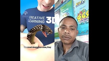what happens inside your body when a Snake bites you # snakebites #short -creativelearning3d