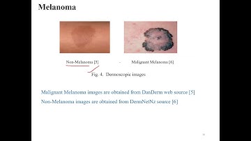 AICTE FDP Day1AN BIomedical signal Processing