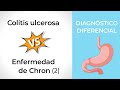 Diagnóstico Diferencial Enfermedad de Crohn vs Colitis Ulcerosa