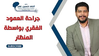 المنظار الجراحي وعلاج الانزلاق الغضروفي / دكتور أحمد حسين عمر