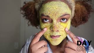 I Tried a Yogurt &amp; Turmeric Face Mask for 5 Days For Hyperpigmentation &amp; Acne Scars