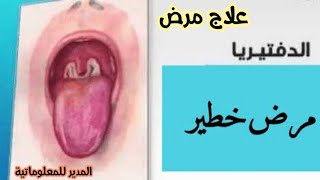 مرض الدفتيريا | اعراض مرض الدفتيريا | الدفتيريا في الجزائر