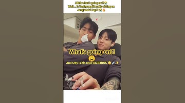What Just Happened?! Taehyung on JK’s Lap… Bleeding?! 😭 #taekookshorts   #taekook #shorts