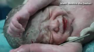 Чудо в Сирии, ребенок был «воскрешён»…