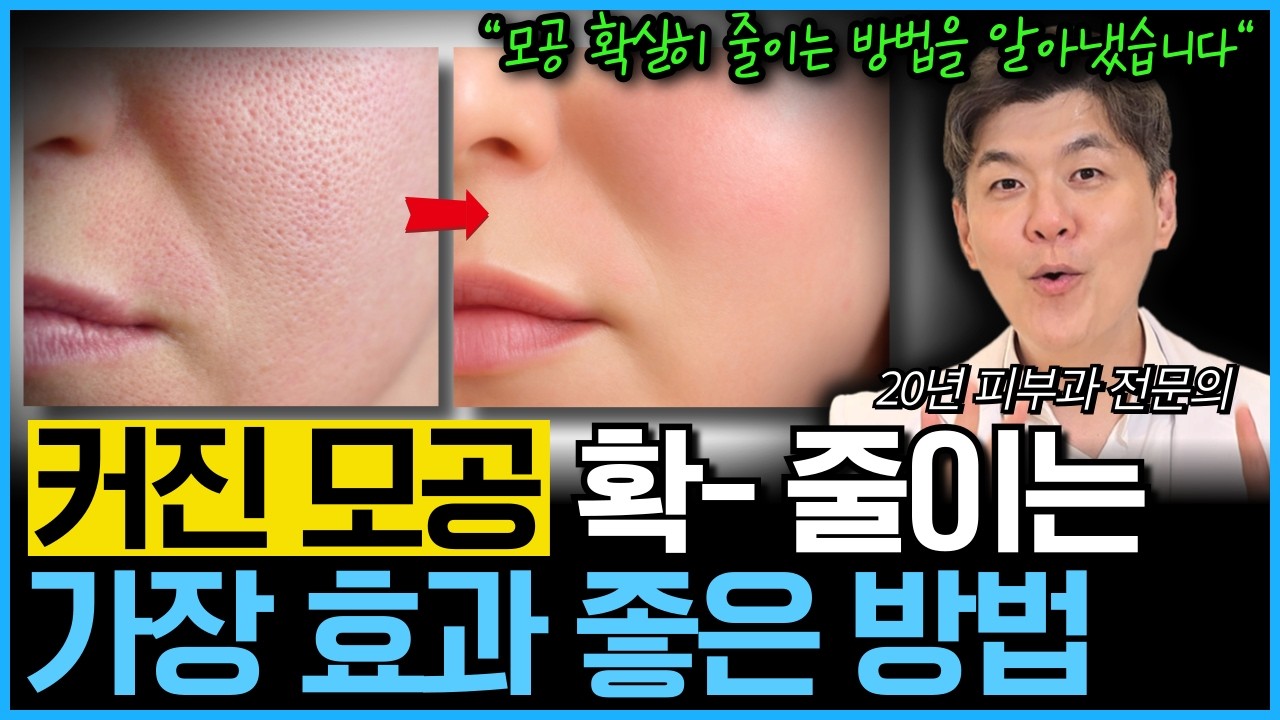 20년만에 알아낸 커진 모공 줄이는 가장 확실한 방법을 피부과 전문의가 제대로 알려드립니다 (연령별 모공 제대로 줄이는 피부과 시술)
