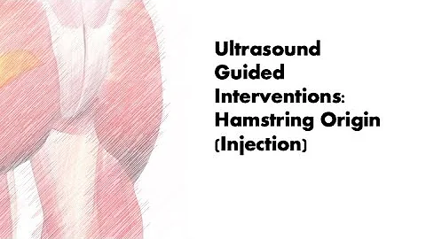 #ultrasound Guided Interventions: Hamstring Origin (Injection) #fyp #sport #sports #sportsmedicine