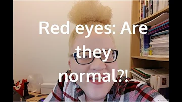 What is wrong with albinos eyes?