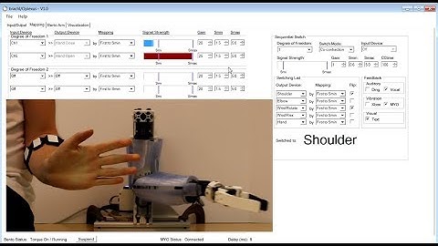 brachI/Oplexus Runthrough Video