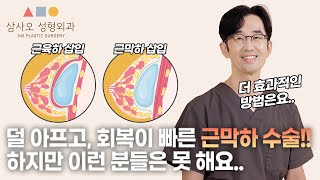 가슴 성형, 근육하 VS 근막하 삽입법 중 더 나은 선택은??_[삼사오 성형외과]