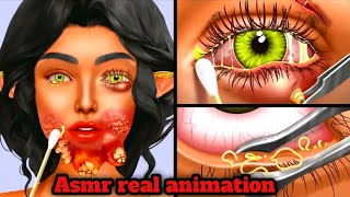 ASMR Therapy for Bee Sting and Sebum Removal | Relaxing Facial Care Animation @relaxingasmr5063