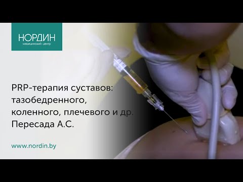 PRP-терапия суставов: коленного, тазобедренного, плечевого. Кому рекомендована, как выполняется