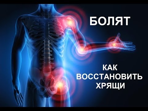Болят суставы. Как восстановить хрящи