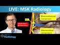 LIVE Stream: MSK Radiology - complex knee injury