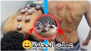 الدكتوره قمر والله 🥺 الحـجامــة و الي حسيتو وانا بعملها🙃|عبد الرحمن مانو