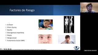 Sesión General. Transplante de Membrana de Bowman en el Manejo de Queratocono. 06 Marzo 2023.