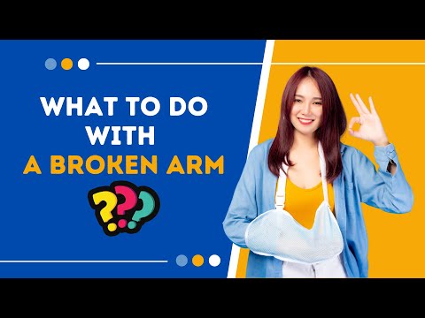 5 Fun Things to Do with a Broken Arm | What to do with a Broken Arm | Leisure activities