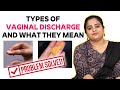 Different Colors of Uterine Discharge And What They Mean | Dr. Kavya Priya Vazrala