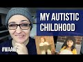 Autism Childhood Memories & Signs