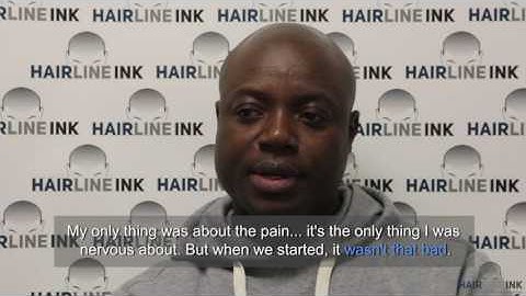 Is Scalp Micropigmentation (SMP) PAINFUL?