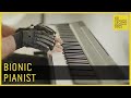 The Magic Gloves of Bionic Pianist João Carlos Martins