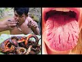 खतरनाक खाद्य पदार्थ जो आपको मार सकते हैं | Dangerous Foods That Can Kill You