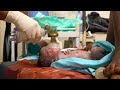 Helping Babies Breathe at Birth (French) - Newborn Care Series