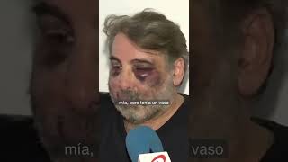 Un grupo de jóvenes da una brutal paliza a un vecino de Ferrol tras pedirles que no hicieran ruido