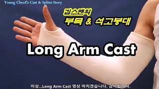 Long Arm Cast