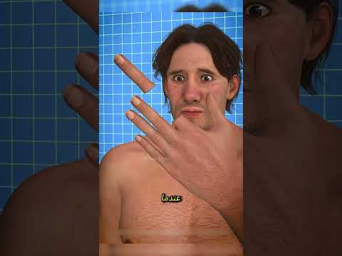 هل تعرف الطريقة الصحيحة لعلاج جرح الإصبع قصص 