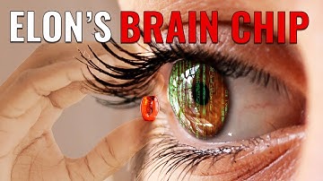 IT HAPPENED! Elon Musk FINALLY Tested Neuralink On Humans!