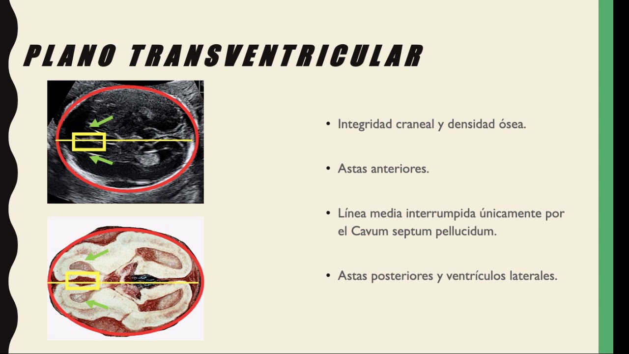 Evaluación de cabeza y cerebro fetal